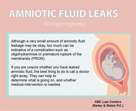 leaking amniotic fluid look like|Leaking Amniotic Fluid: How to Tell